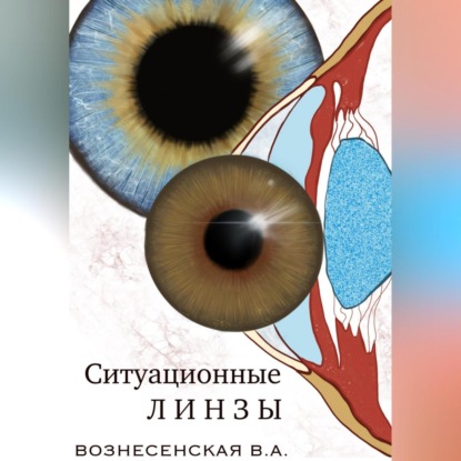 Ситуационные линзы (Валерия Алексеевна Вознесенская)